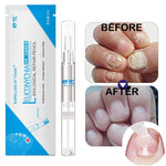 Herbal Nail Fungus Treatment Pen