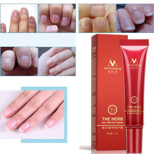 Nail Treatment Cream