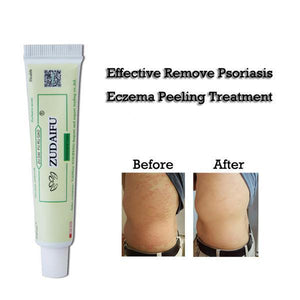 Advanced Psoriasis & Eczema Cream